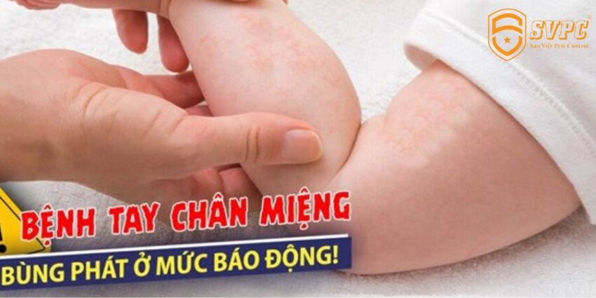 Dấu hiệu bện tay chân miệng