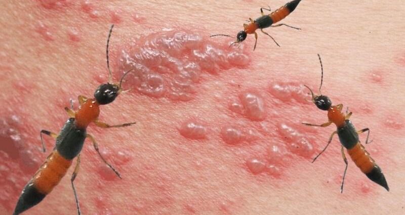 Côn trùng gây bệnh mối nguy thầm lặng cho sức khỏe gia đình